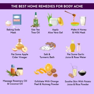 sApcWGxBgthe best home remedies - Daily Health Tips: Simple Tricks for a Healthier Life Acne